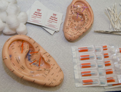 Acupuncture: Healing Without Dreaded Side Effects