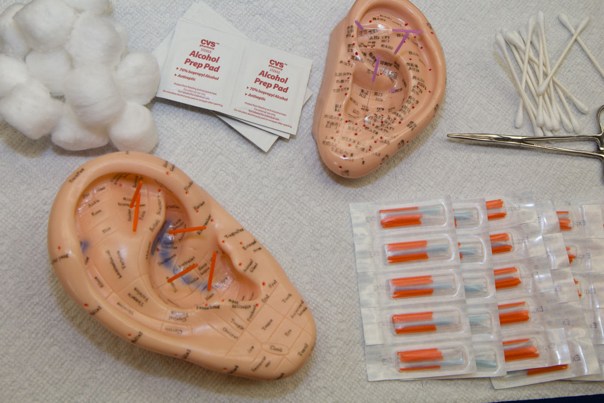 "Accupuncture-1" by musicvet2003 is licensed under CC BY-NC 2.0